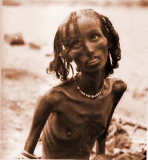 Starving African Woman